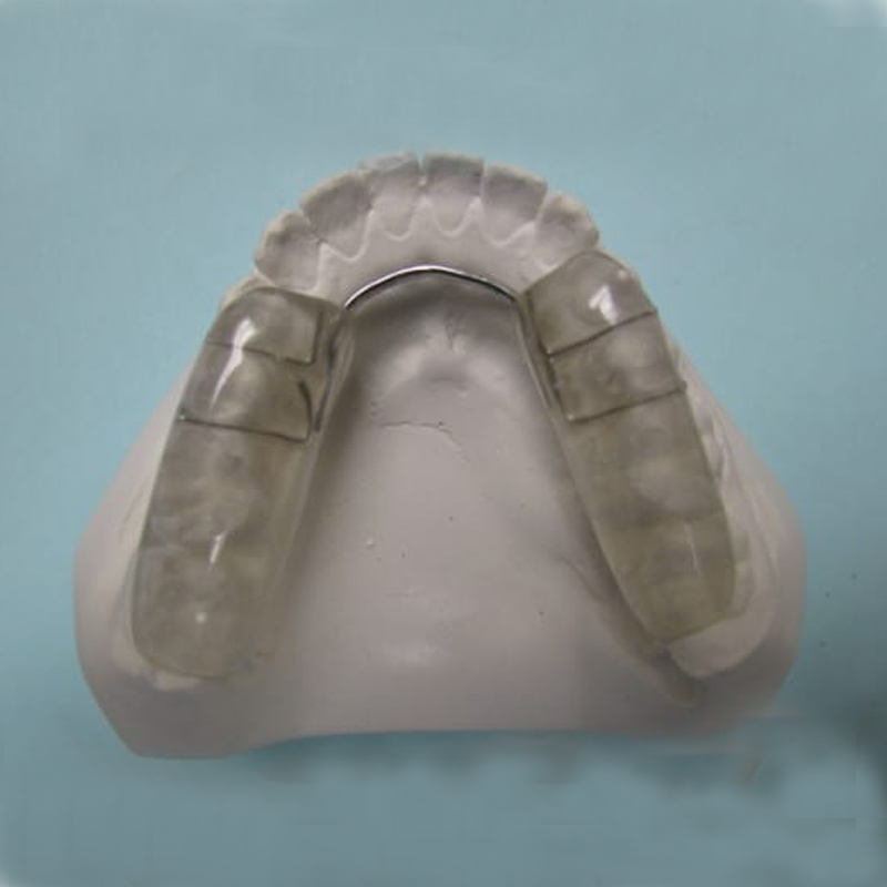 occlusal splints को भूमिका