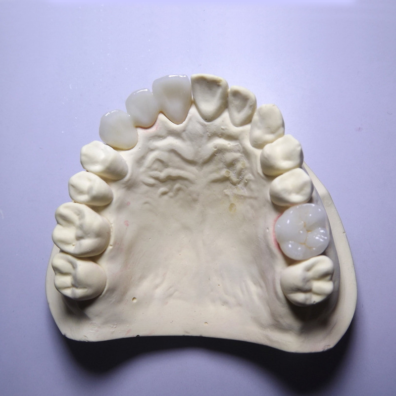 Zirconia को फाइदा के हो?