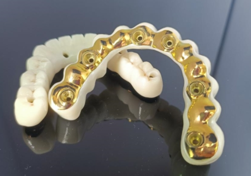 CAD/CAM टाइटेनियम इम्प्लान्ट बार + जिरकोनिया ब्रिज
