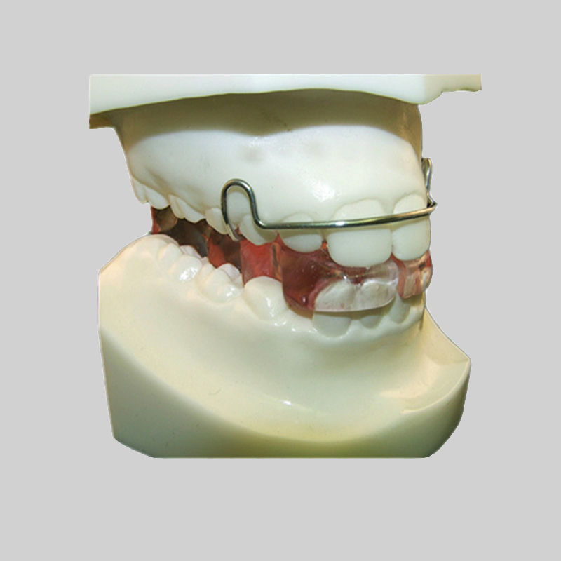ओर्थरोडोन्टिक्स र orthododontic उपचार बीच के भिन्नता छ?