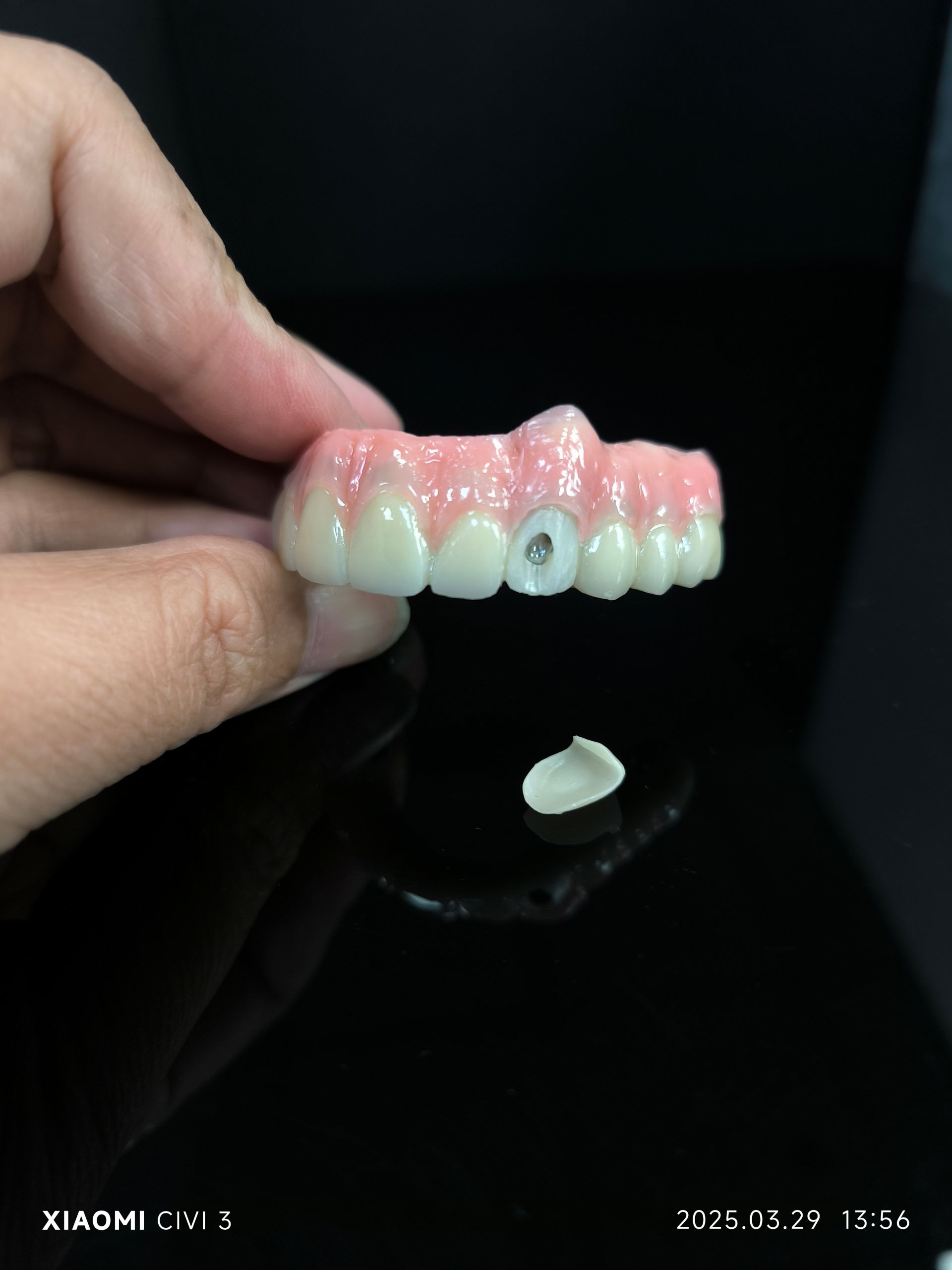 सबै 4 - usbriid zirconia Prochions BeCher को प्वालको लागि