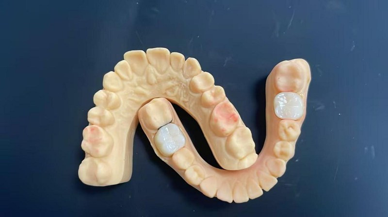 काँधको किनारा के हो?