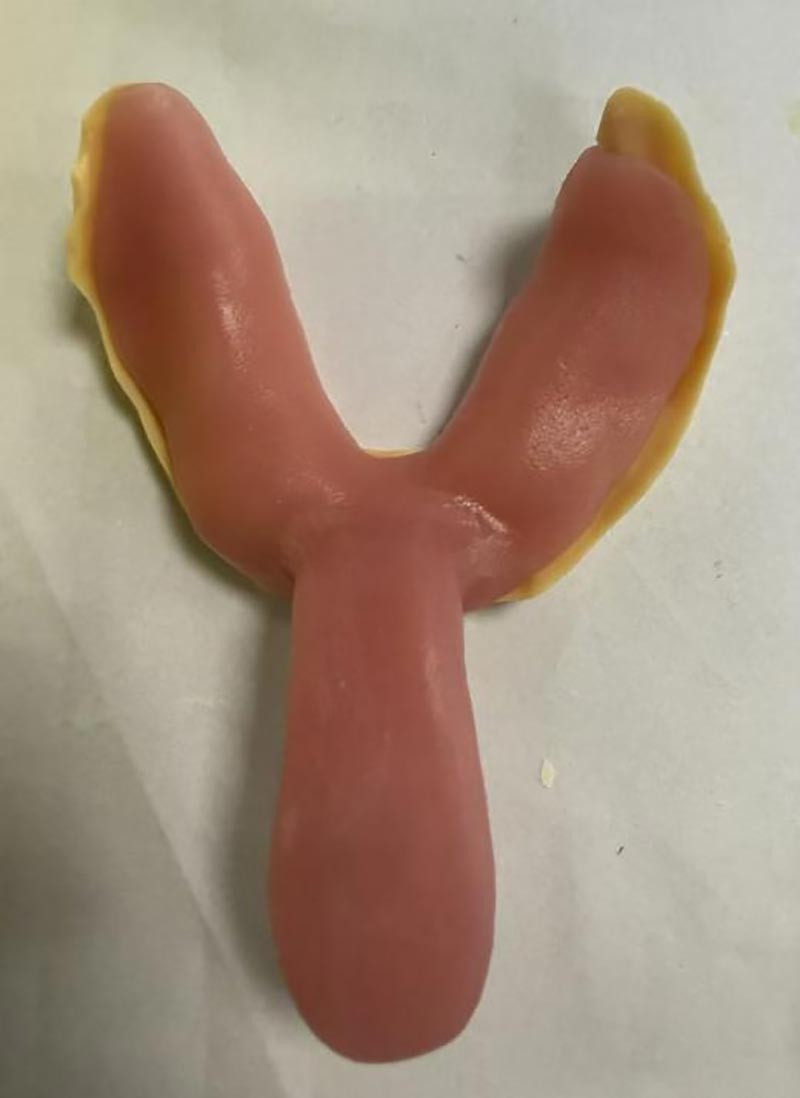 कस्टम डेन्टल ट्रे बारे तपाईलाई थाहा नभएका कुराहरू