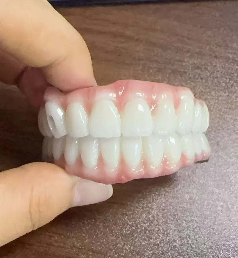 Malocclusion को खतराहरू