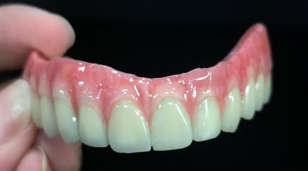 सबै hyly हाइब्रिड - मल्को ब्रिज पूर्ण Zirconia proconia proanium संरचना