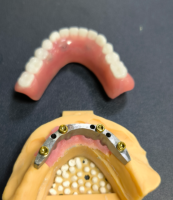 लोकेटर र दन्त बार